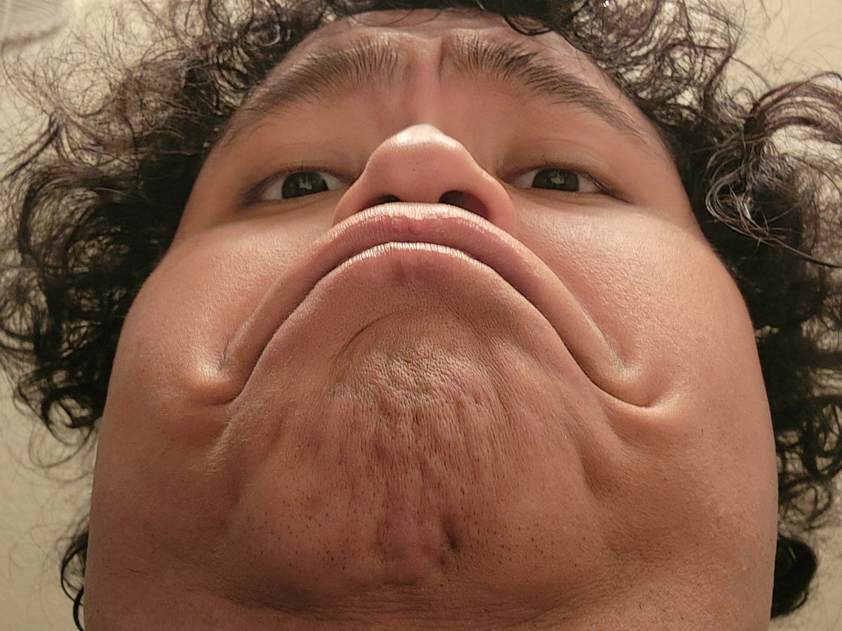 RVDesigns2003's tweet image. Can you draw with a 1st degree burn??