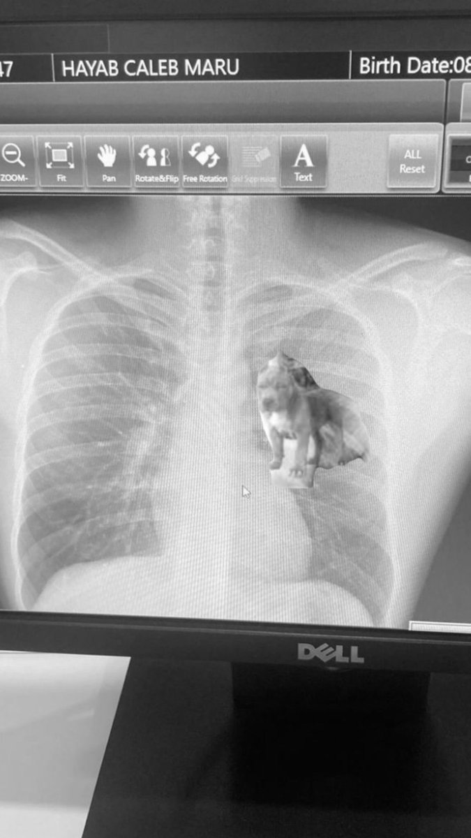 calebmaru's tweet image. X-ray came back 
Still got that dawg in me