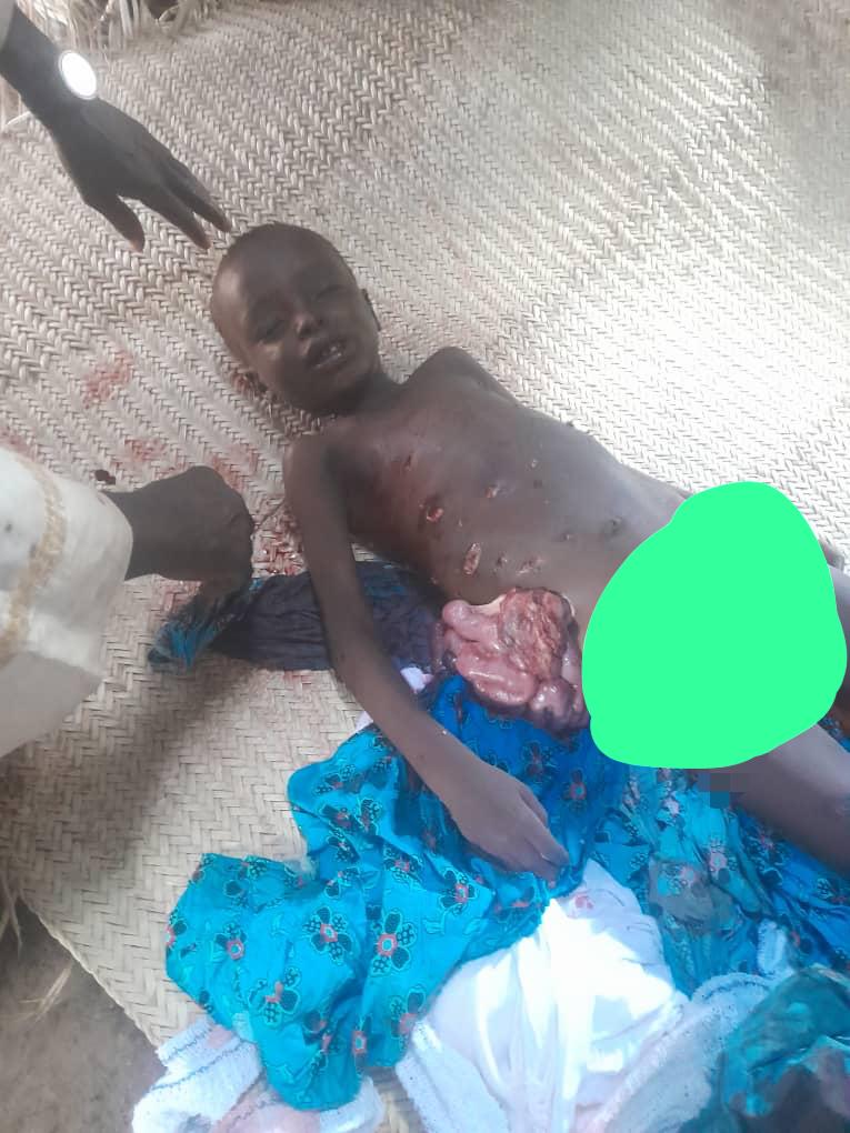 HumanityPurpose's tweet photo. #Désastre| #AttaqueAnimale 02.10.2024
Un #chacal a tenté de devourer un enfant dans les environs de #Biamo (#Cameroun). Il a été abattu par la population. L'enfant a succombé alors qu'on s'apprêtait à le transporter à l'Hôpital de #Mada.
#MINFOF #MINEPDED #ParcWaza #ParcKalamalou https://t.co/A7iFcA3S1v