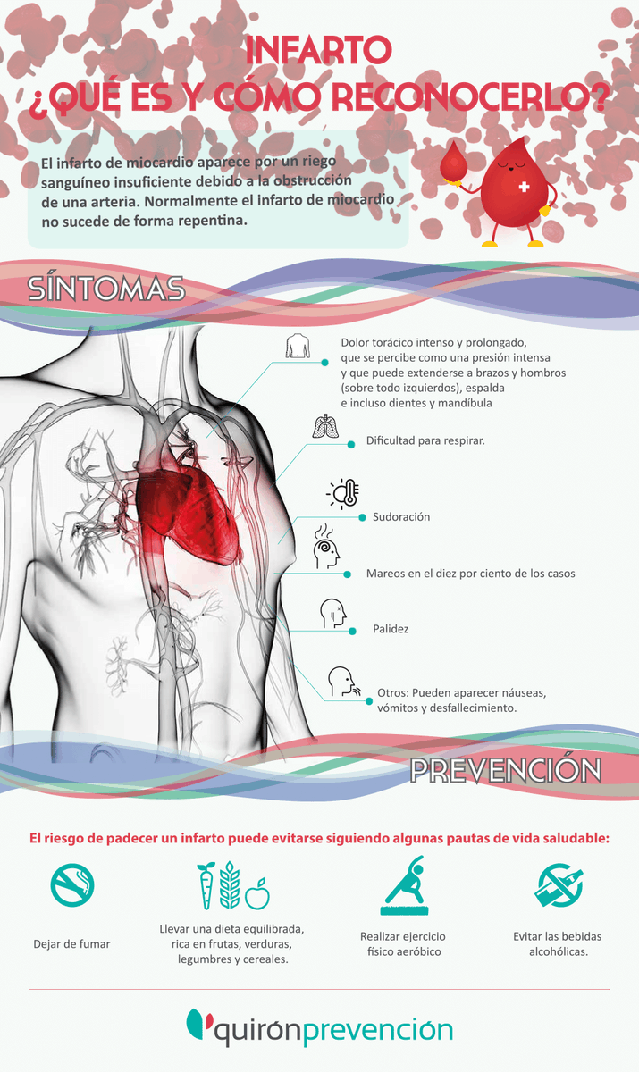 #Infografía | El dolor en el brazo no es la única señal que nos alerta de un #infarto. ¡Consulta los otros síntomas! 👇