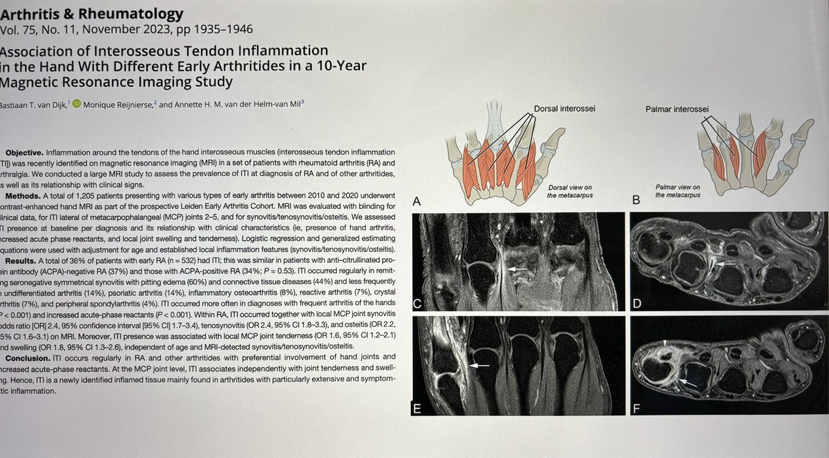 Encantado de participar con los Dres Benavent (H Bellvitge) y Corominas (H SPau) en la Mesa de Imagen del #SimposioAR24

<a href="/SEReumatologia/">Soc.Esp.Reumatología</a>