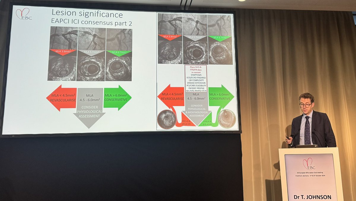 Ivana Iveljic (@1blueivy) on Twitter photo Great saturday morning in Frankfurt
🔺News session at <a href="/BifurcationClub/">European Bifurcation Club</a>
▶️Key concepts of EBC Angio and EAPCI-EBC imaging consensus Great saturday morning in Frankfurt
🔺News session at <a href="/BifurcationClub/">European Bifurcation Club</a>
▶️Key concepts of EBC Angio and EAPCI-EBC imaging consensus
