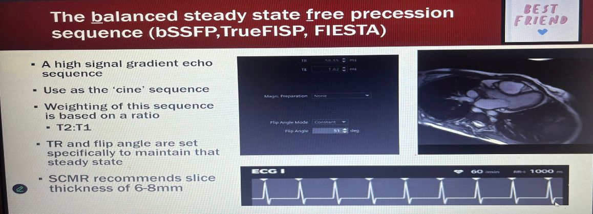 It was great to have a comprehensive overview of Cardiac MRI from Andrea Cradock UCD today at the IIRRT MRI webinar #MRI24 #UCD #IIRRT