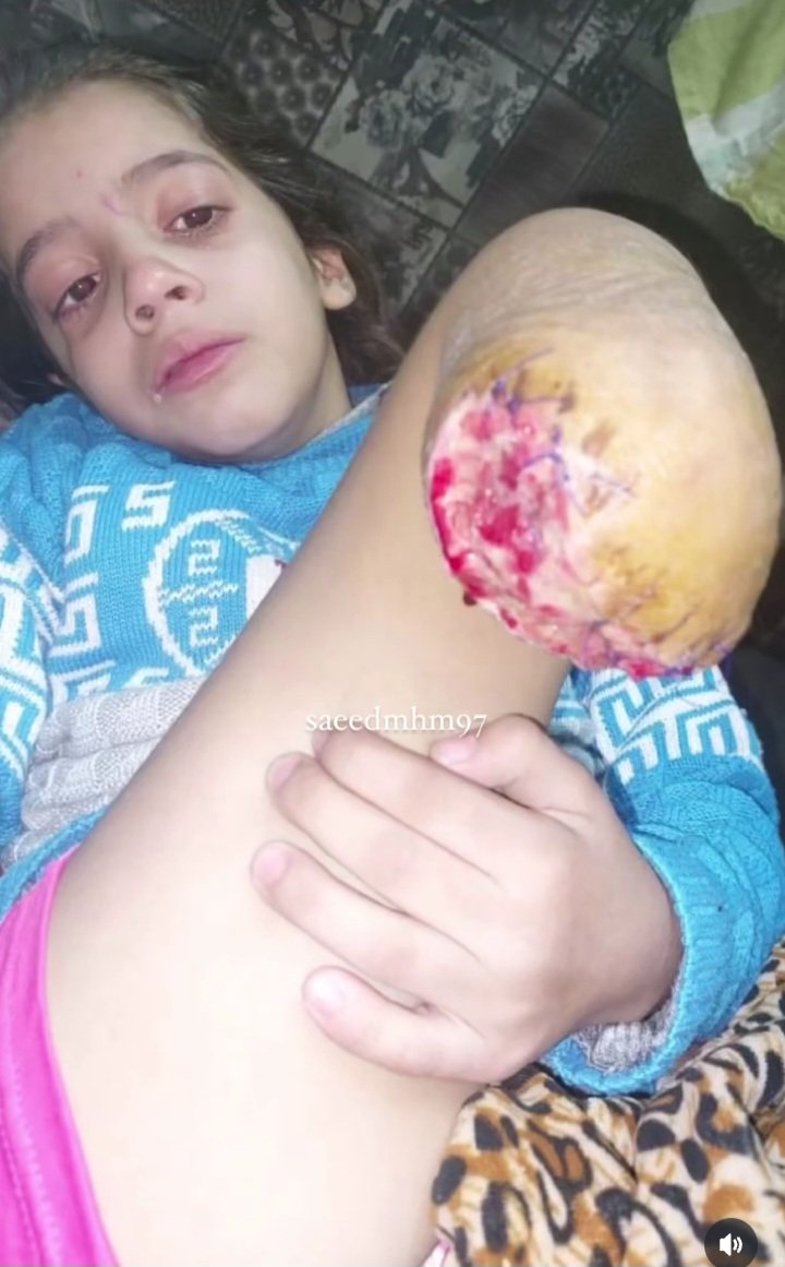 النازية الإسرائيلية✡️
 في ابشع صورها!!!! 
#اوقفوا_الابادة