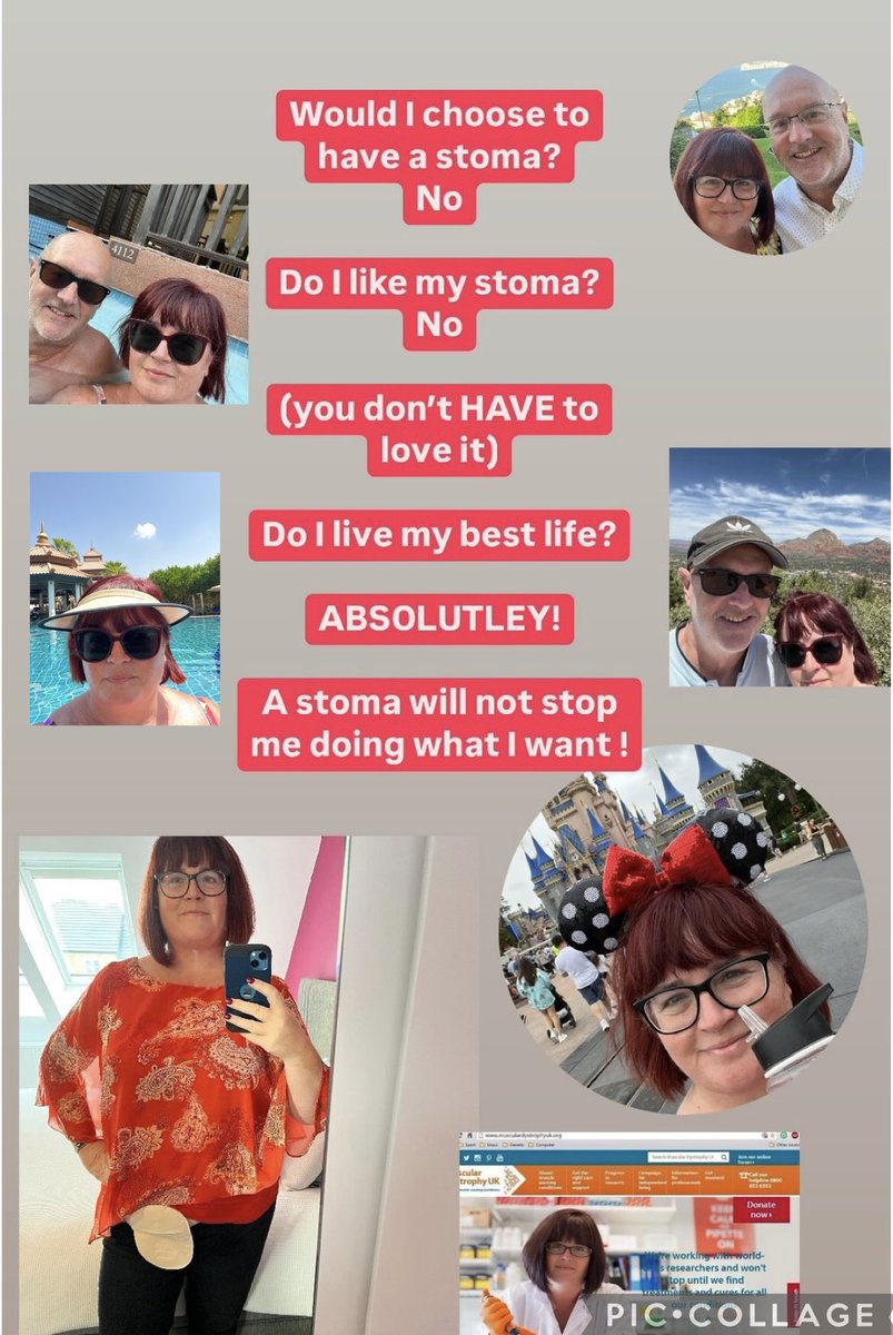 Sarah Squire (@sarahsquire73) on Twitter photo On #WorldOstomyDay I reflect on 17y with a stoma. Iāll never love it but am damned if it will rule my life. It has brought many friendships (too many to tag), Iām Chair of <a href="/ACPGBI_PLG/">ACPGBI-PLG</a>, a <a href="/Coloplast_UK/">Coloplast UK & Ireland</a> ambassador & love to be a voice for patients in many projects. Life is good ā¤ļø On #WorldOstomyDay I reflect on 17y with a stoma. Iāll never love it but am damned if it will rule my life. It has brought many friendships (too many to tag), Iām Chair of <a href="/ACPGBI_PLG/">ACPGBI-PLG</a>, a <a href="/Coloplast_UK/">Coloplast UK & Ireland</a> ambassador & love to be a voice for patients in many projects. Life is good ā¤ļø
