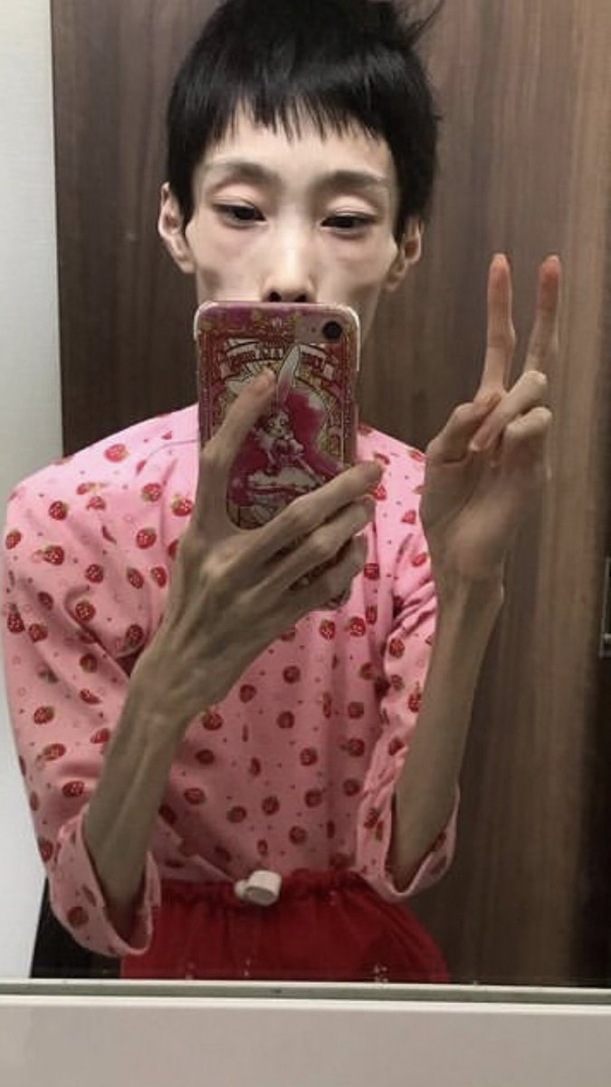 240628j's tweet photo. #拒食症 #痩せ姫 #拒食障害　#拒食　#摂食障害

#体系記録 #腕の細さ #骸骨 #自撮り
#痩せ　#セクシー
#プリキュア大好き　#私は可愛い
#下剤依存 #オムツ #メルちゃん https://t.co/ClZOyGdNki