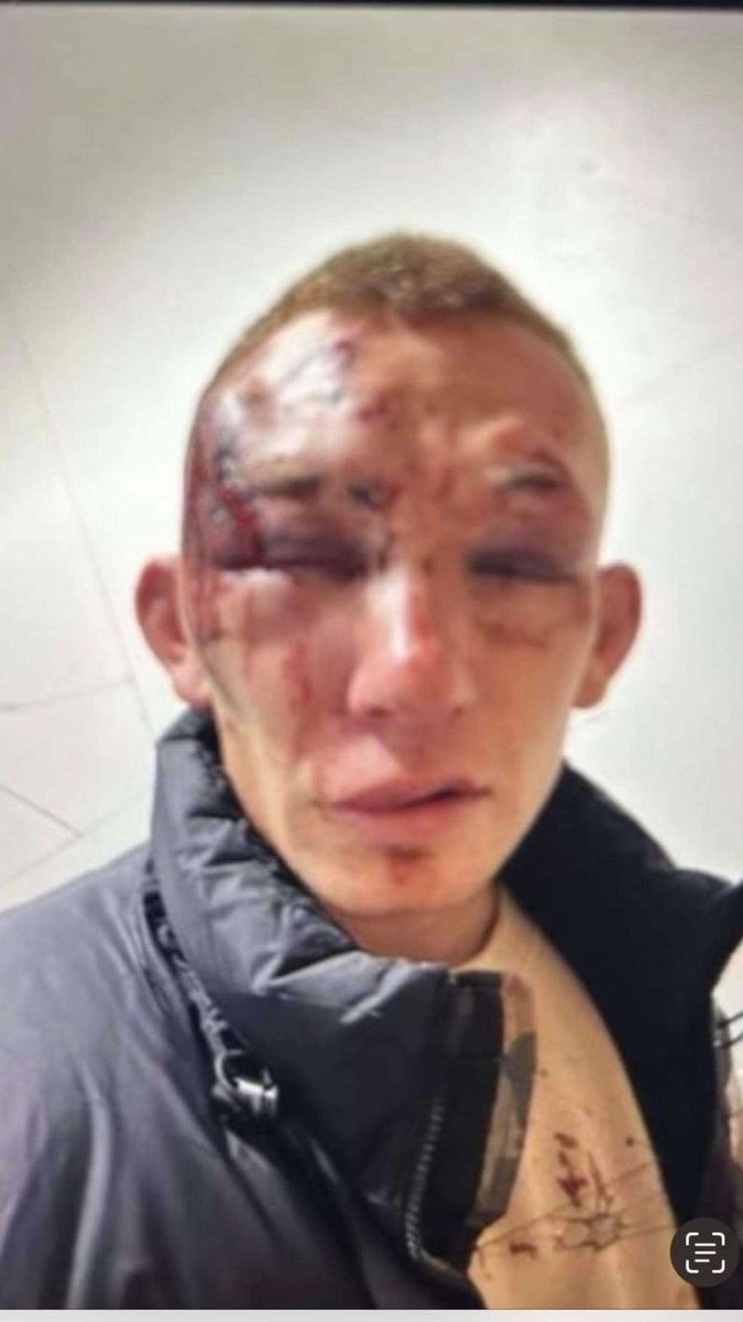 Lee Anderson MP tweet media