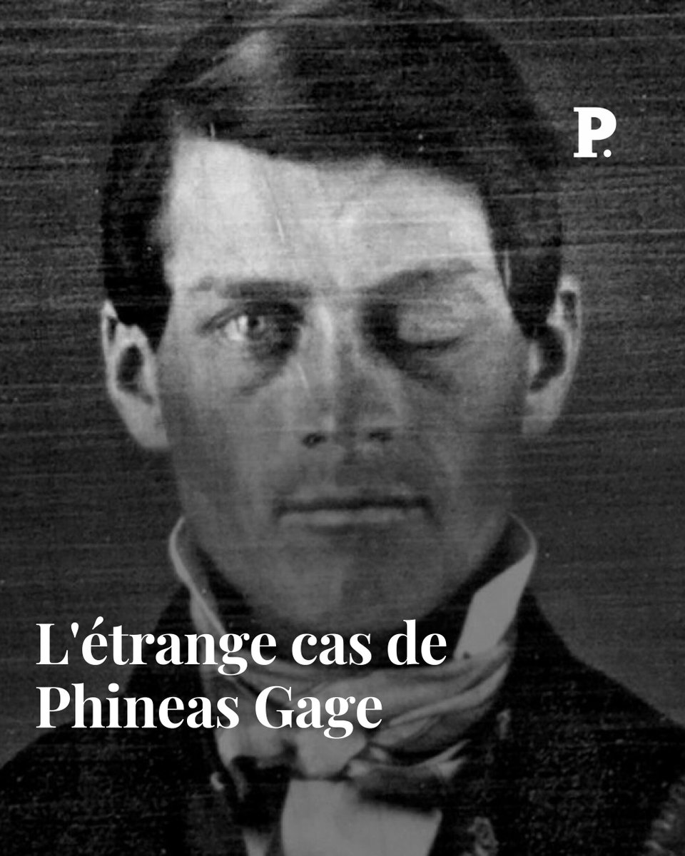 Après avoir eu le cerveau transpercé par une barre à mine, Phineas Gage a continué de vivre, mais avec un changement de personnalité. 

Une histoire qui a marqué la médecine neurologique.

➡️ l.lepoint.fr/3BR
Par <a href="/Joseph1LeCorre/">Le Corre Joseph</a> #ARelire