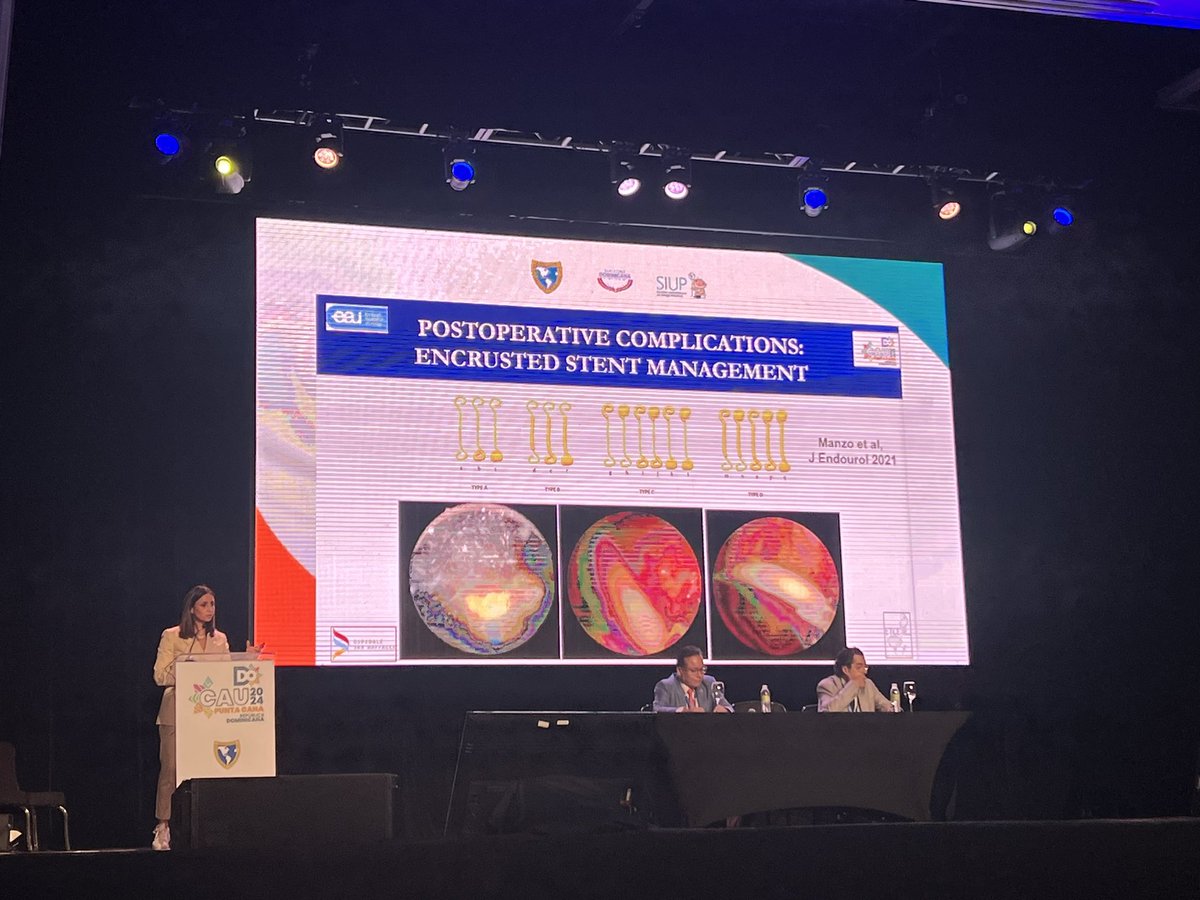 Our VGUES paper for encrusted stents, presented in #CAU2024 by one of the most recognized urologists around the world <a href="/sproietti81/">Silvia Proietti</a> in an outstanding lecture about complications en flexible ureteroscopy. With no doubt one of best lectures at #CAU2024. 

<a href="/smumexico/">SMU México</a> <a href="/CAU_URO/">Confederación Americana de Urología (CAU)</a>