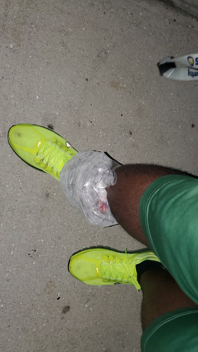 Driving home after being cleated on the sideline was a challenge.  Cruise control ✅️