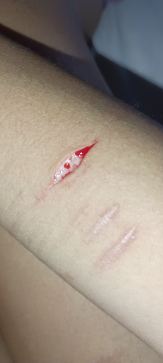 vick_strves's tweet photo. tw//sh
looks kinda like an eyeball lmfao https://t.co/rN06zyON4A