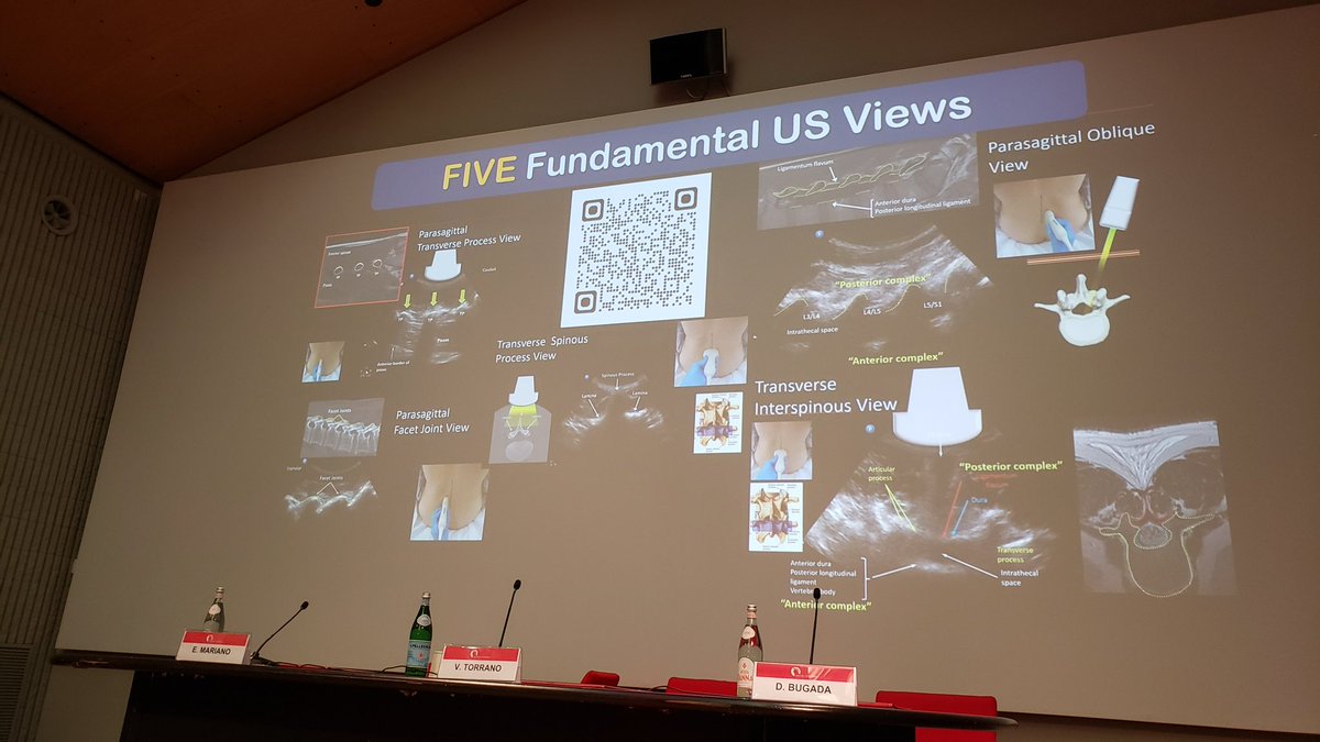 EMARIANOMD's tweet photo. From the master! Prof @KiJinnChin gives his top tips for ultrasound-guided neuraxial blocks and key references: 

Kalagara et al: https://t.co/z3l0tLwKxR 

Prof Chin's YouTube channel: https://t.co/vMTfggSjBA 

One of my favs: https://t.co/0IOHxdCGsN

#BicoccaAcademy https://t.co/NFHlJ1YmaS