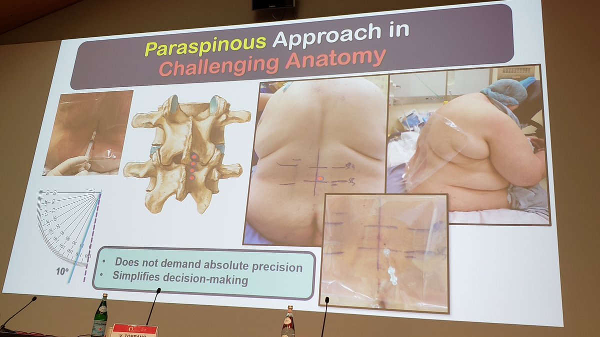 From the master! Prof <a href="/KiJinnChin/">Ki Jinn Chin</a> gives his top tips for ultrasound-guided neuraxial blocks and key references: 

Kalagara et al: link.springer.com/article/10.100… 

Prof Chin's YouTube channel: youtube.com/@kijinnchin 

One of my favs: pubs.asahq.org/anesthesiology…

#BicoccaAcademy