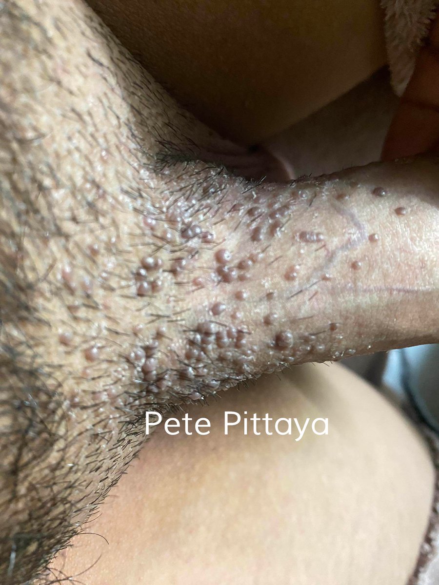 Pete Pittaya tweet media