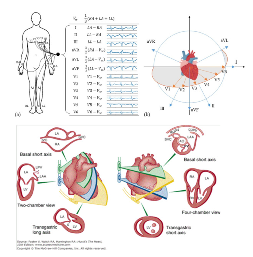 medntdj's tweet image. Deep learning-based approaches for myocardial infarction detection: A comprehensive review recent advances and emerging challenges
doi.org/10.1016/j.medn…
#Echocardiogram #Electrocardiograph
#MedTwitter #scicomm #MedEd #AcademicTwitter