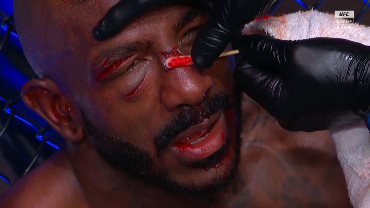 DovySimuMMA's tweet photo. Khalil got sliced up #UFC307 https://t.co/2AKmmjE9F6