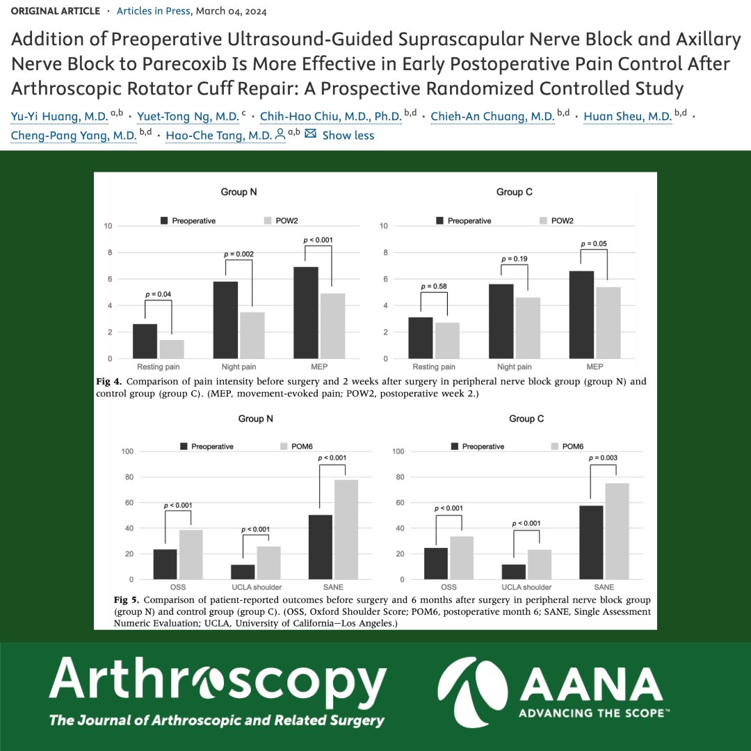 ArthroscopyJ's tweet photo. How well do ultrasound-guided suprascapular and axillary nerve blocks mitigate pain following rotator cuff surgery? #PainManagement #SuprascapularNerveBlock #AxillaryNerveBlock #RotatorCuffSurgery
https://t.co/fjULrid3TY https://t.co/rb0yhHqeUY