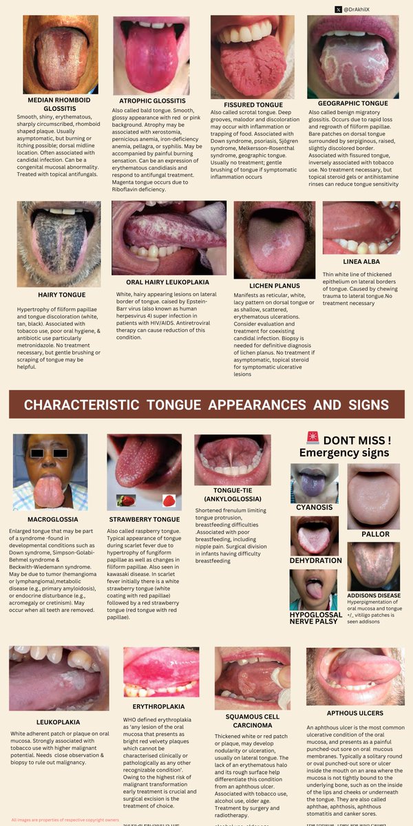 docakx's tweet photo. Characteristic appearances of tongue in various conditions https://t.co/EYTH8JXCq1