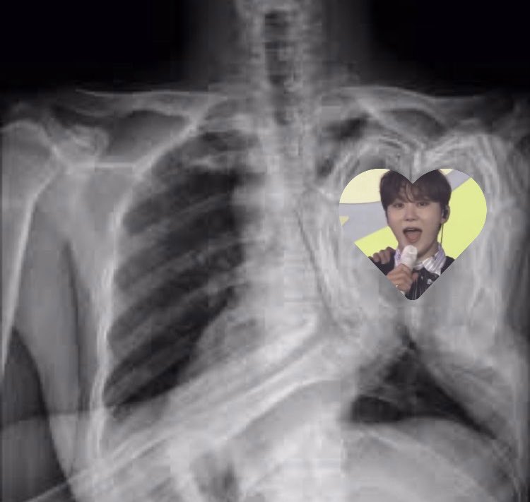 내 심장에 부승관 있다 콩닥콩닥 ෆ⸒⸒