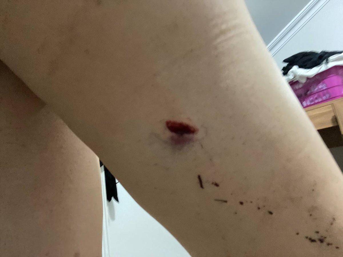 Daha önce metro istasyonunda takıntılı olduğu eski sevgilisini bıçaklamaya kalkan şahıs HALA ELİNİ KOLUNU SALLAYARAK DIŞARDA GEZİYOR.

Adı Arda Baran Bayer. Eski sevgilisine 5 aydır hayatı zindan ediyor. Defalarca tehdide, şiddete maruz kalan arkadaşımız KORKTUĞU İÇİN şikayetçi