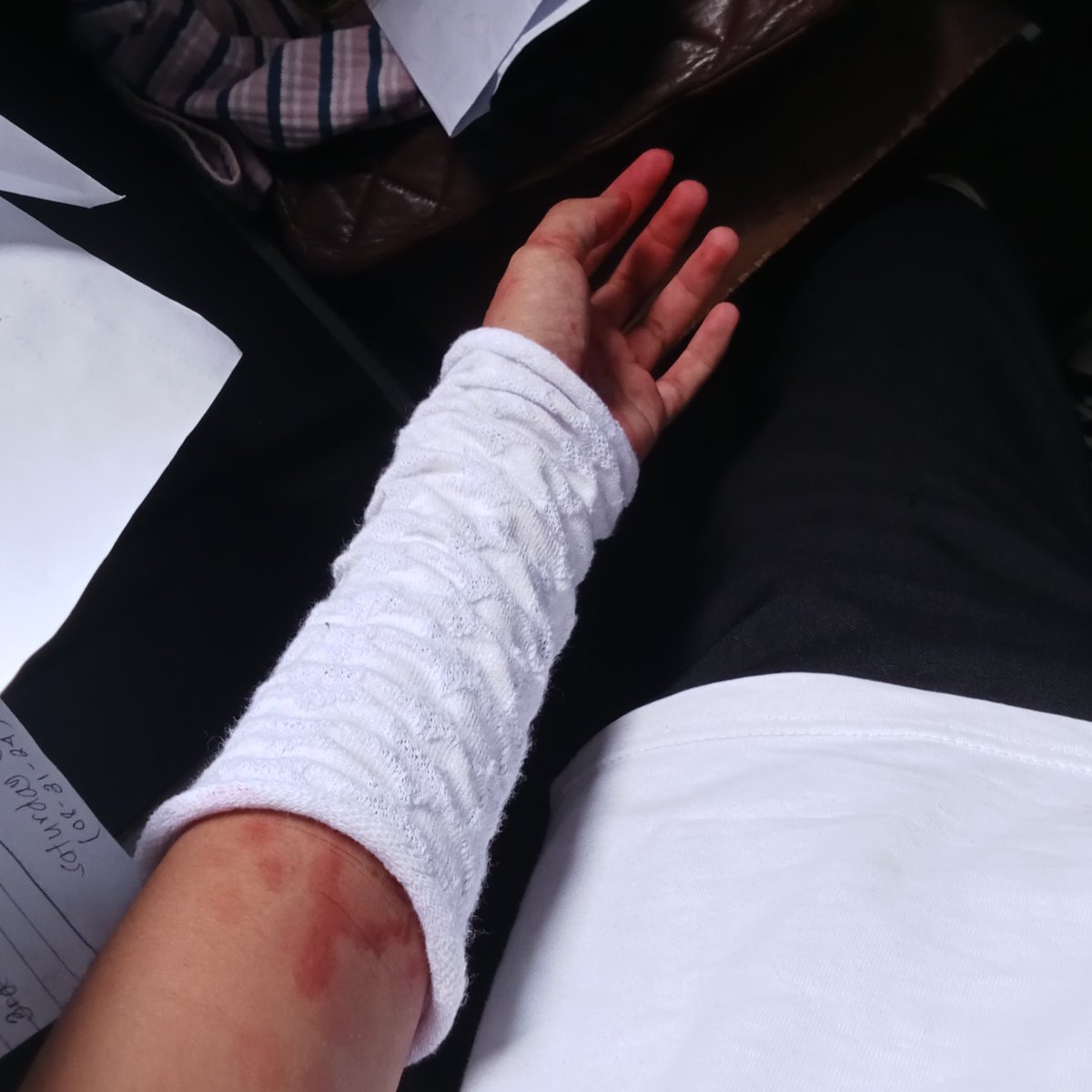 chamochipu's tweet photo. My baby is shy #selfharm #sh https://t.co/AMYuVDILgb