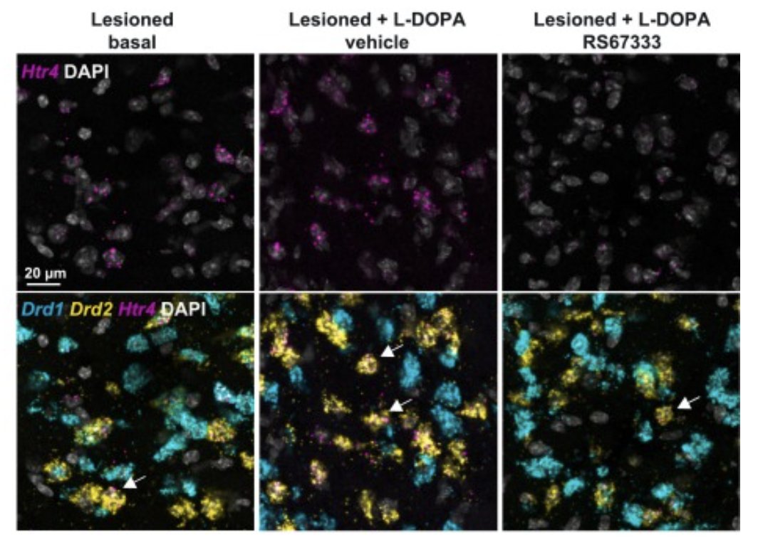 Inserm Paris 5 Ipnp (@insermu1266) on Twitter photo Publication alert! The serotonin 4 receptor plays a role in mediating side effects elicited by L-DOPA in a mouse model of Parkinson's: Ballardin et al. …irect-com.proxy.insermbiblio.inist.fr/science/articl…
<a href="/GhuParis/">GHU Paris Psy-Neuro</a> <a href="/InsermIDF/">Inserm Île-de-France</a> <a href="/Insermu1266/">Inserm Paris 5 Ipnp</a> #Parkinsons Publication alert! The serotonin 4 receptor plays a role in mediating side effects elicited by L-DOPA in a mouse model of Parkinson's: Ballardin et al. …irect-com.proxy.insermbiblio.inist.fr/science/articl…
<a href="/GhuParis/">GHU Paris Psy-Neuro</a> <a href="/InsermIDF/">Inserm Île-de-France</a> <a href="/Insermu1266/">Inserm Paris 5 Ipnp</a> #Parkinsons