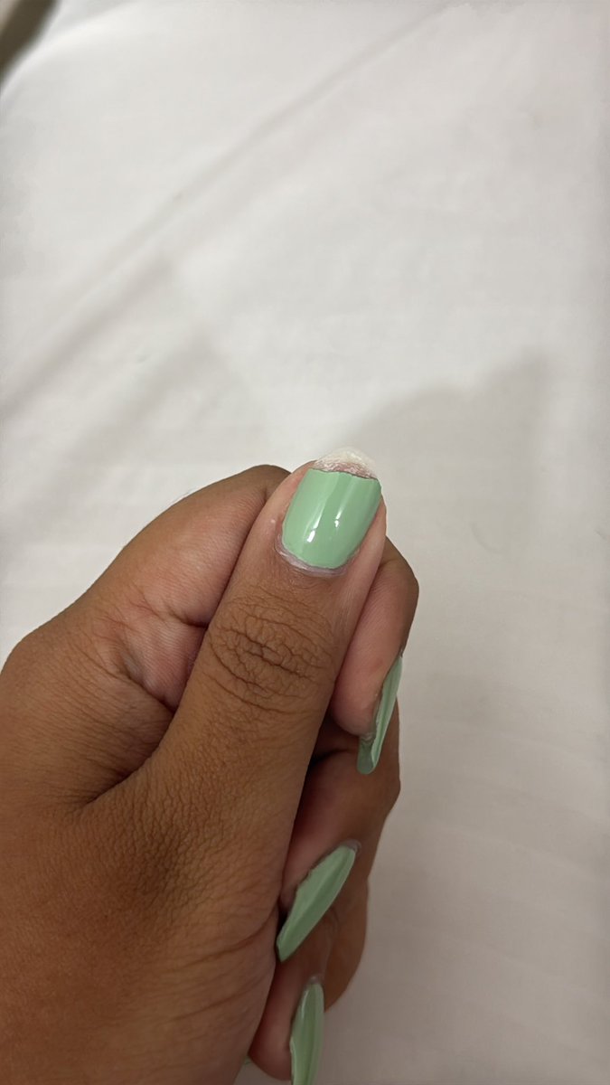 krisgc_'s tweet photo. Acompáñenme en esta triste historia
El sábado pasado fui a nail bar de villa lucre por un servicio de rubber.
A solo 4 días de habérmelo realizado se me partió una uña, día 5 se me agrietó otra y ayer el rubber como que se desprendió ya que como ven en la foto la uña sigue allí. https://t.co/Q17MsgZZ3J
