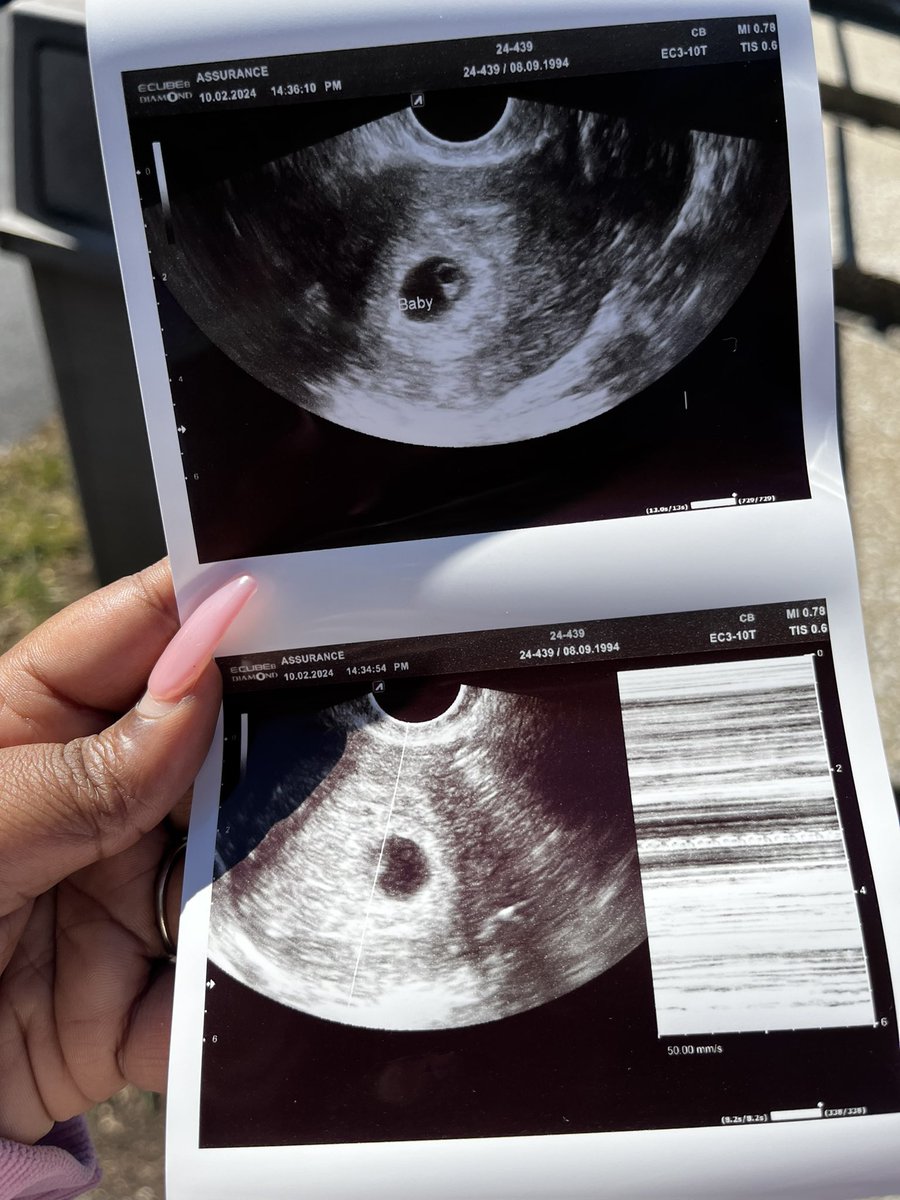 Lauren-Shay: LA 👑 tweet media