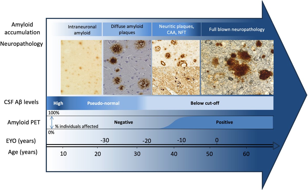 The Lancet (@thelancet) on Twitter photo Biomarkers of neurodegeneration: the global challenges and benefits are are explored in a new <a href="/LancetLongevity/">The Lancet Healthy Longevity</a>–<a href="/eBioMedicine/">eBioMedicine – The Lancet Discovery Science</a> Series ⤵️
hubs.li/Q02ShzW10
These biomarkers have the potential to enhance clinical research and diagnosis, but their use is highly Biomarkers of neurodegeneration: the global challenges and benefits are are explored in a new <a href="/LancetLongevity/">The Lancet Healthy Longevity</a>–<a href="/eBioMedicine/">eBioMedicine – The Lancet Discovery Science</a> Series ⤵️
hubs.li/Q02ShzW10
These biomarkers have the potential to enhance clinical research and diagnosis, but their use is highly