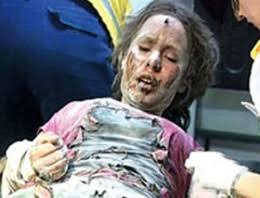 FightcClup1's tweet image. Ben Serap Eser, 8 Kasım 2009&apos;da dershaneden evime dönerken PKK yandaşı etnik bölücüler tarafından yakılarak öldürüldüm.

Daha 17 Yaşındaydım!