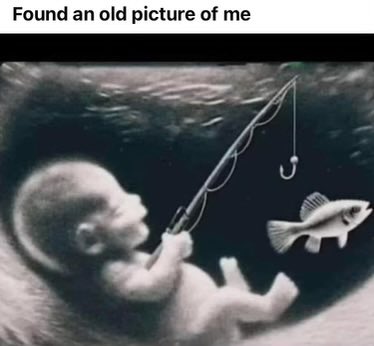 Didn't know they had ultrasound in 1967 ...