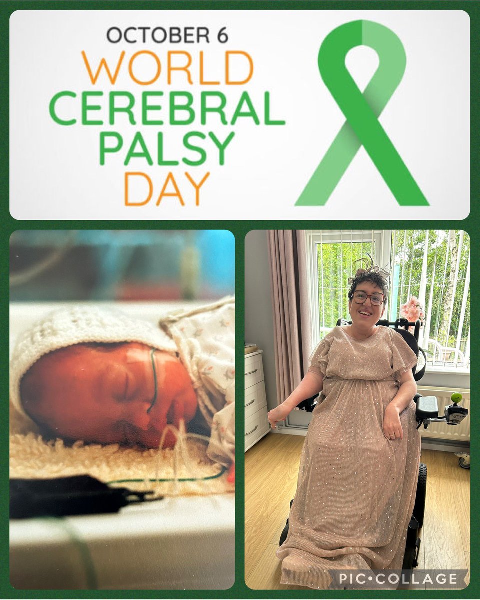 JFaye86's tweet photo. ⭐️⭐️⭐️ WORLD CEREBRAL PALSY DAY ⭐️⭐️⭐️

There are some aspects of having Cerebral Palsy that frustrate me but, on the whole, I am grateful for everything that this condition has brought me. I mean, without it, I wouldn’t know half the people reading this post!
#WorldCPDay https://t.co/zOdcacuJfO