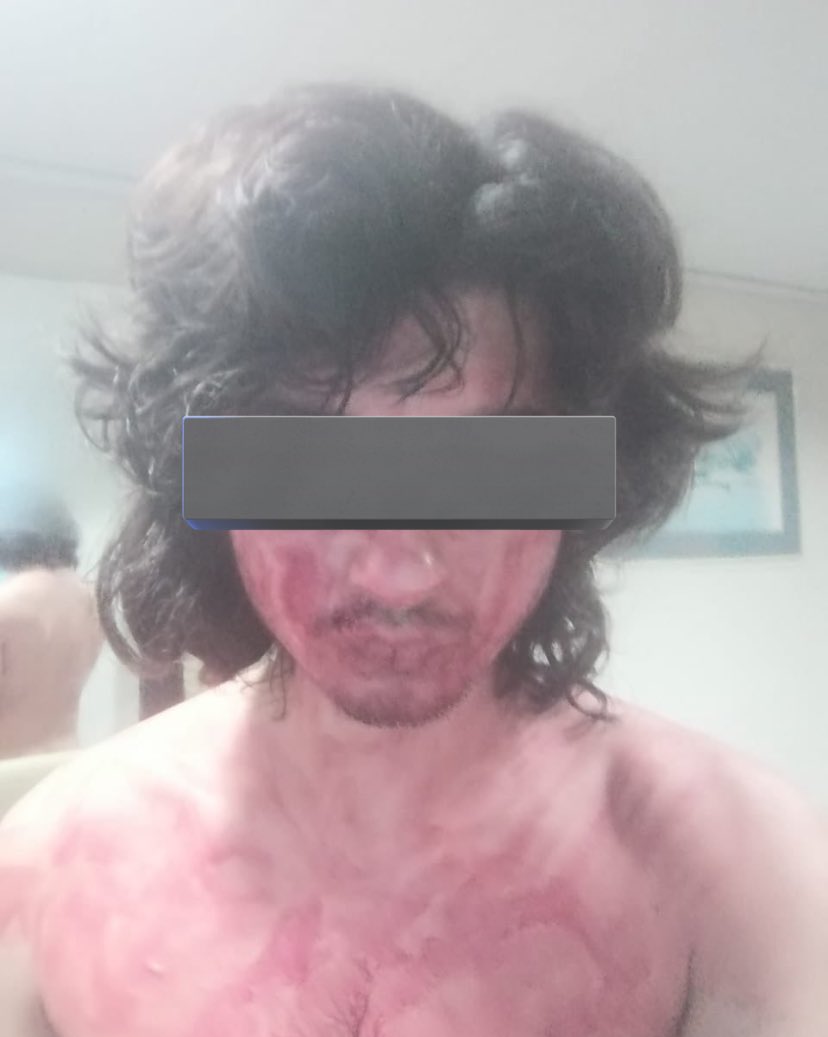 jettsknifes's tweet photo. a**** t**** s**** , 2007'li, iki kız kardeşe sahip... annesi balıkesirli babası osmaniyeli zamanında savcı olan babası FETÖDEN içeri girdi fakat önceki senelerde hollanda'ya kaçmışlar bir sürü masum kızı hem sözlü, hem online, hem de cinsel olarak taciz ediyor. https://t.co/xlzUsCNKVp