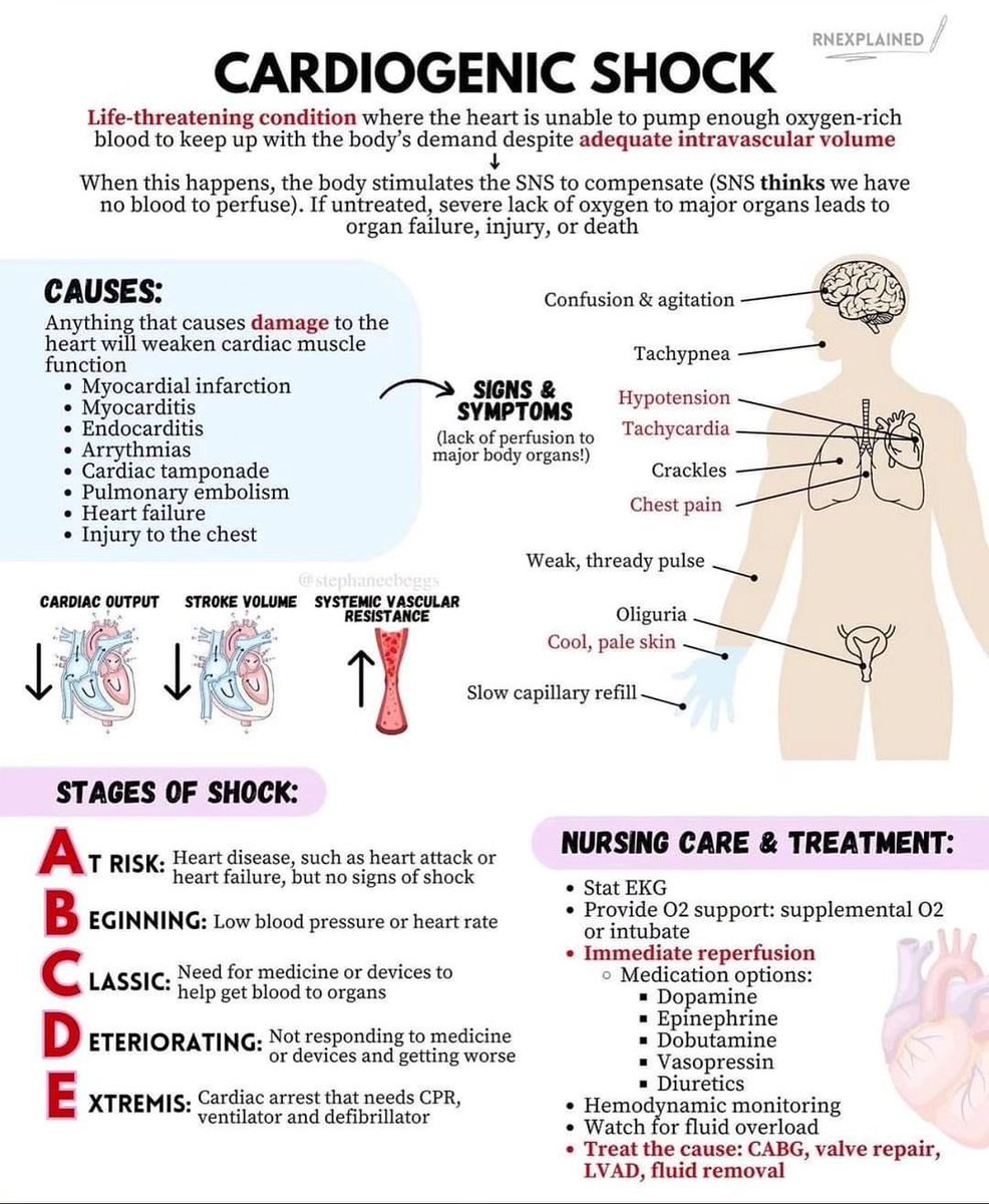Cardiogenic Shock🫀