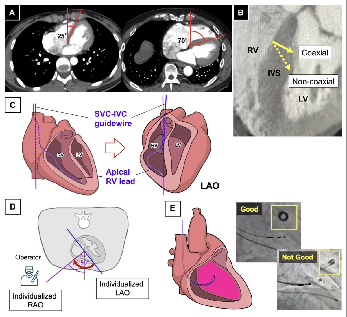 Heart Rhythm Case Reports tweet media
