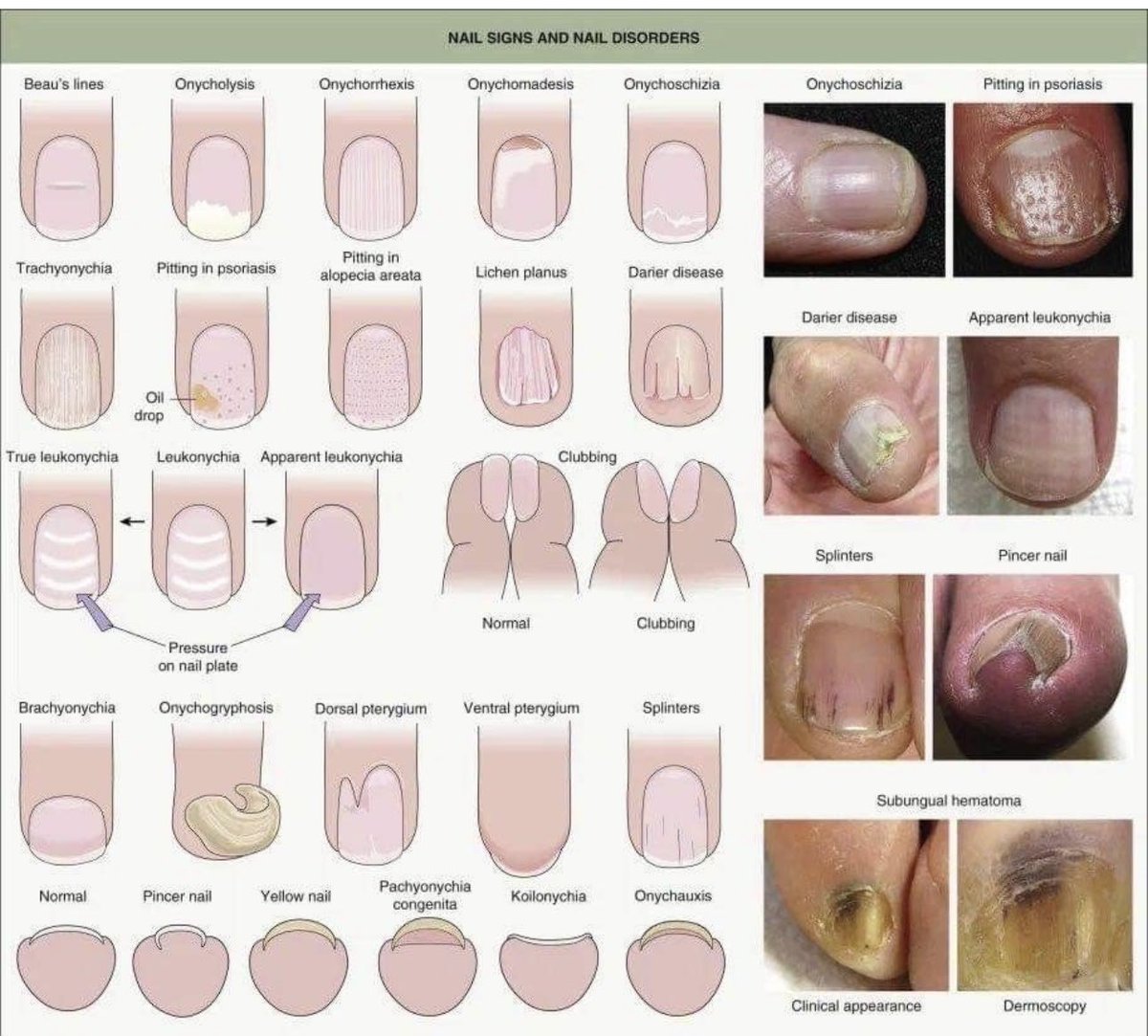Oren Gottfried, MD tweet media