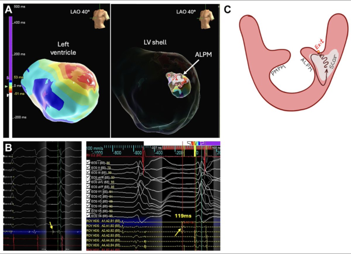 Heart Rhythm Case Reports tweet media