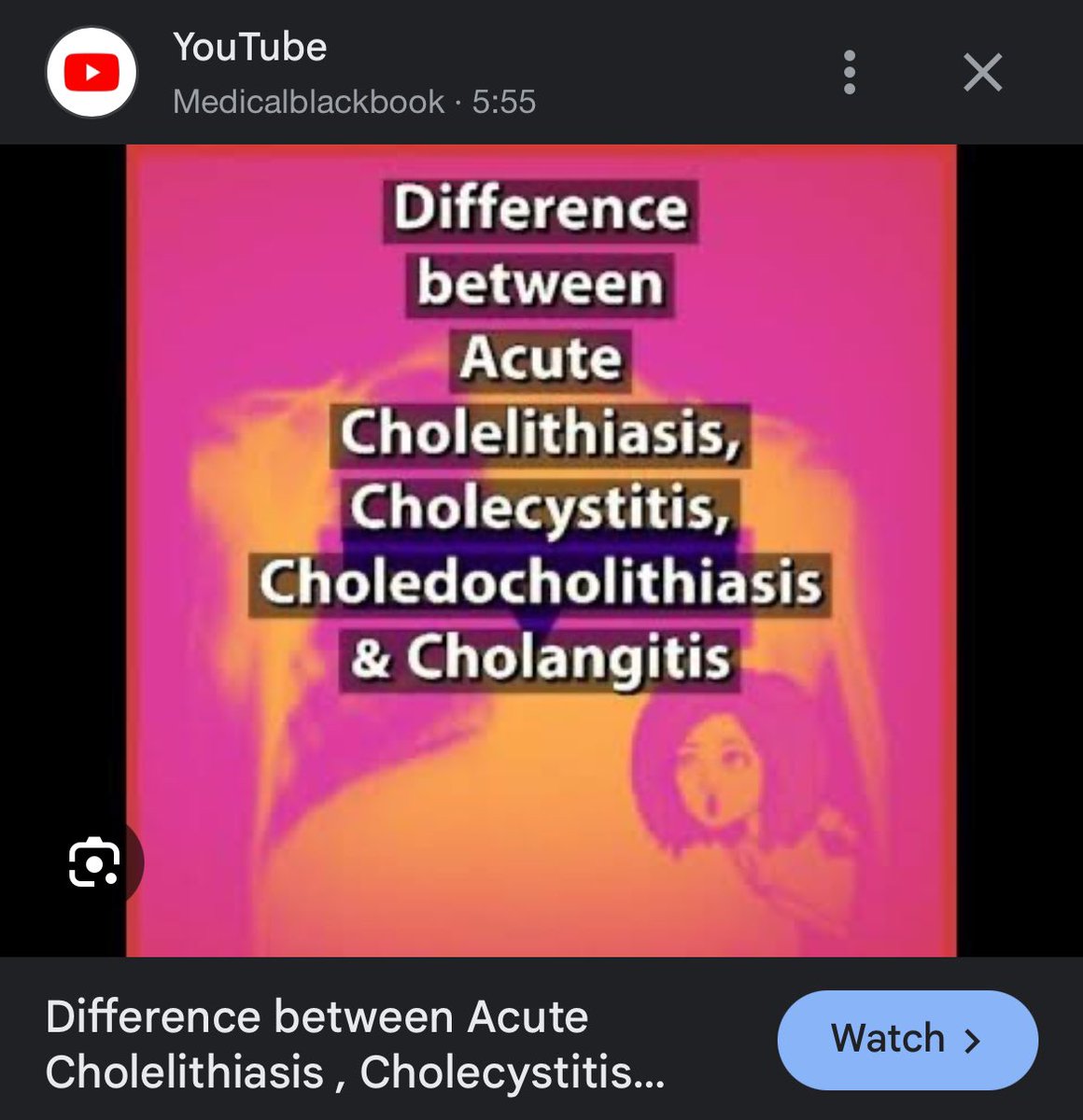 Grreenno's tweet photo. On my way to learn about the difference between: Cholelithiasis, cholecystitis, cholangitis and choledocholithiasis for the 1000th time 🤡 https://t.co/0XrfHL3XKN