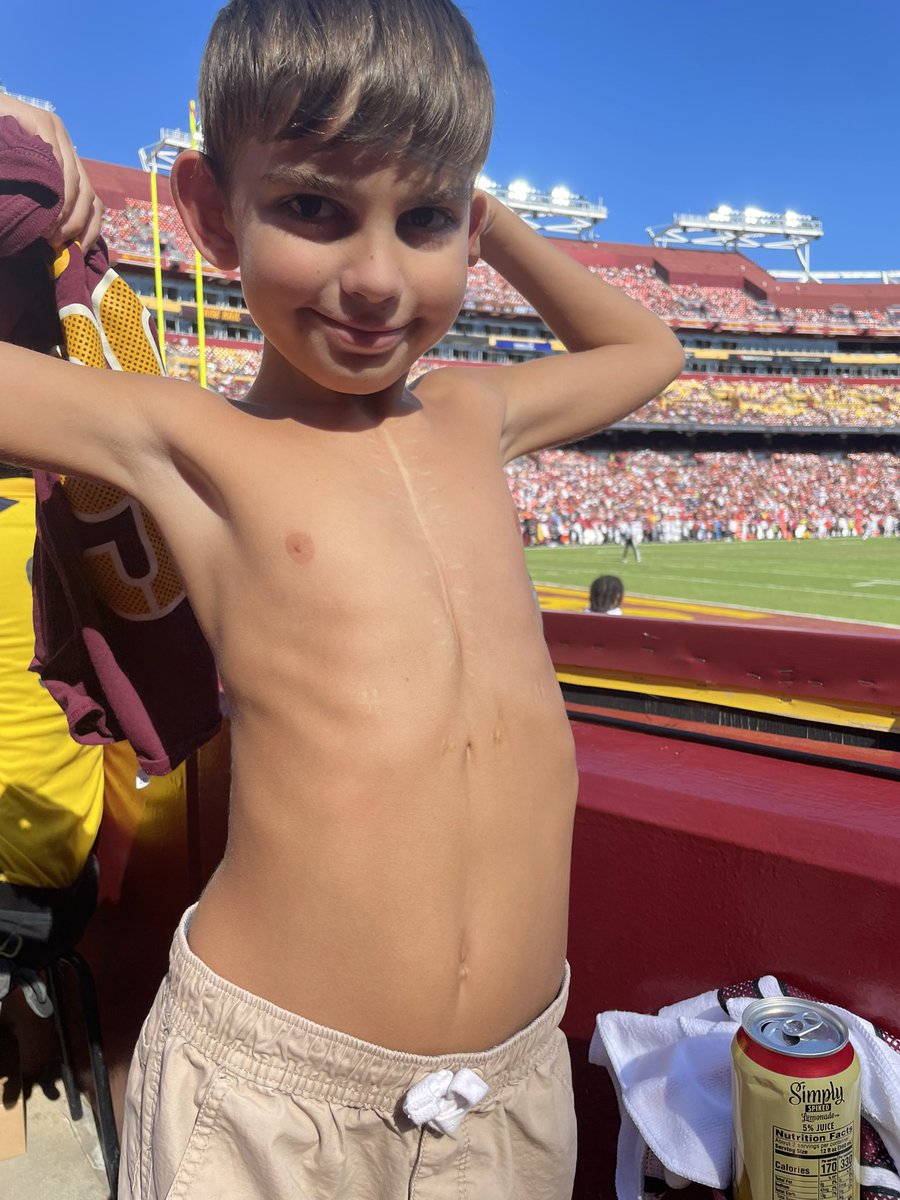 Halftime show with <a href="/AndraDayMusic/">Andra Day</a> was amazing!!!!  Rise Up has so much meaning to our family with my son who lives with heart disease!  It was a pleasure to meet you today!!!