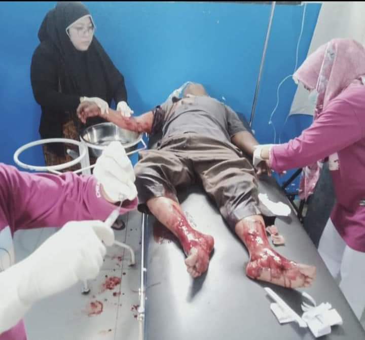96Aal's tweet photo. Seorang bapak di serang babi hutan 
Masuk pekampungan. Di larikan di rumah sakit Padang 
#viralreelsシ #infoviral #babihutan #beranda #BiggBossTamil8 #IsraelTerroristState #digitalart #DAY6 #tewiter #semuaorang https://t.co/eyIwZFe96j