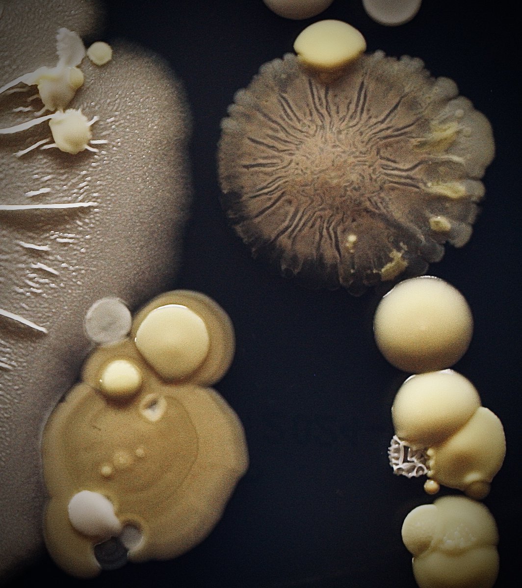 tasturm1's tweet image. #DescribeThatMicrobe So much texture and color going on in these 2 images of a microbial handprint. @ASMicrobiology @HardyDiagnostic #Microbiology #Science #SciComm