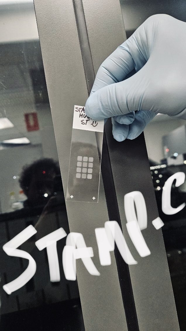 Single-Cell Profiling Done Dirt Cheap

I had a few really good suggestions via DM….here it is:

In the examples below, #STAMP accommodated multi-sample, multi-question experiments with diverse sample quality, RNA content, and cell numbers, guaranteeing no clogs or sample loss,
