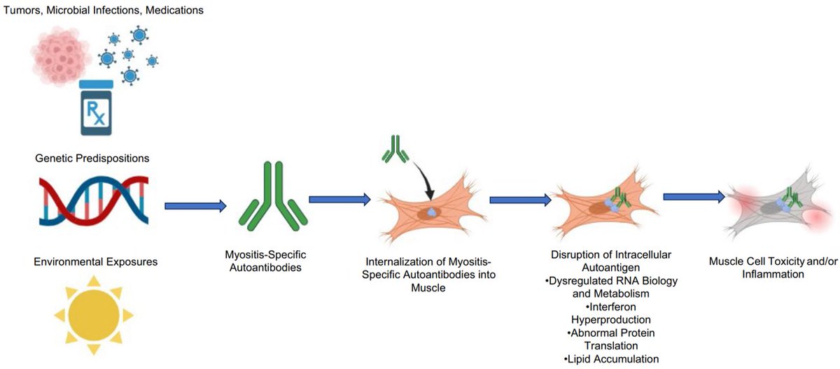 Dr Ai Lyn Tan (@drailyntan) on Twitter photo Factors that contribute to #myositis-specific autoantibodies which can infiltrate #muscle cells
▶️Pre-existing diseases
▶️Microbial infections
▶️Medications
▶️Genetic predispositions
▶️Environmental exposures
👉🏽link.springer.com/article/10.100…
by <a href="/DrIagoPinal/">Iago Pinal-Fernandez</a> et al Factors that contribute to #myositis-specific autoantibodies which can infiltrate #muscle cells
▶️Pre-existing diseases
▶️Microbial infections
▶️Medications
▶️Genetic predispositions
▶️Environmental exposures
👉🏽link.springer.com/article/10.100…
by <a href="/DrIagoPinal/">Iago Pinal-Fernandez</a> et al
