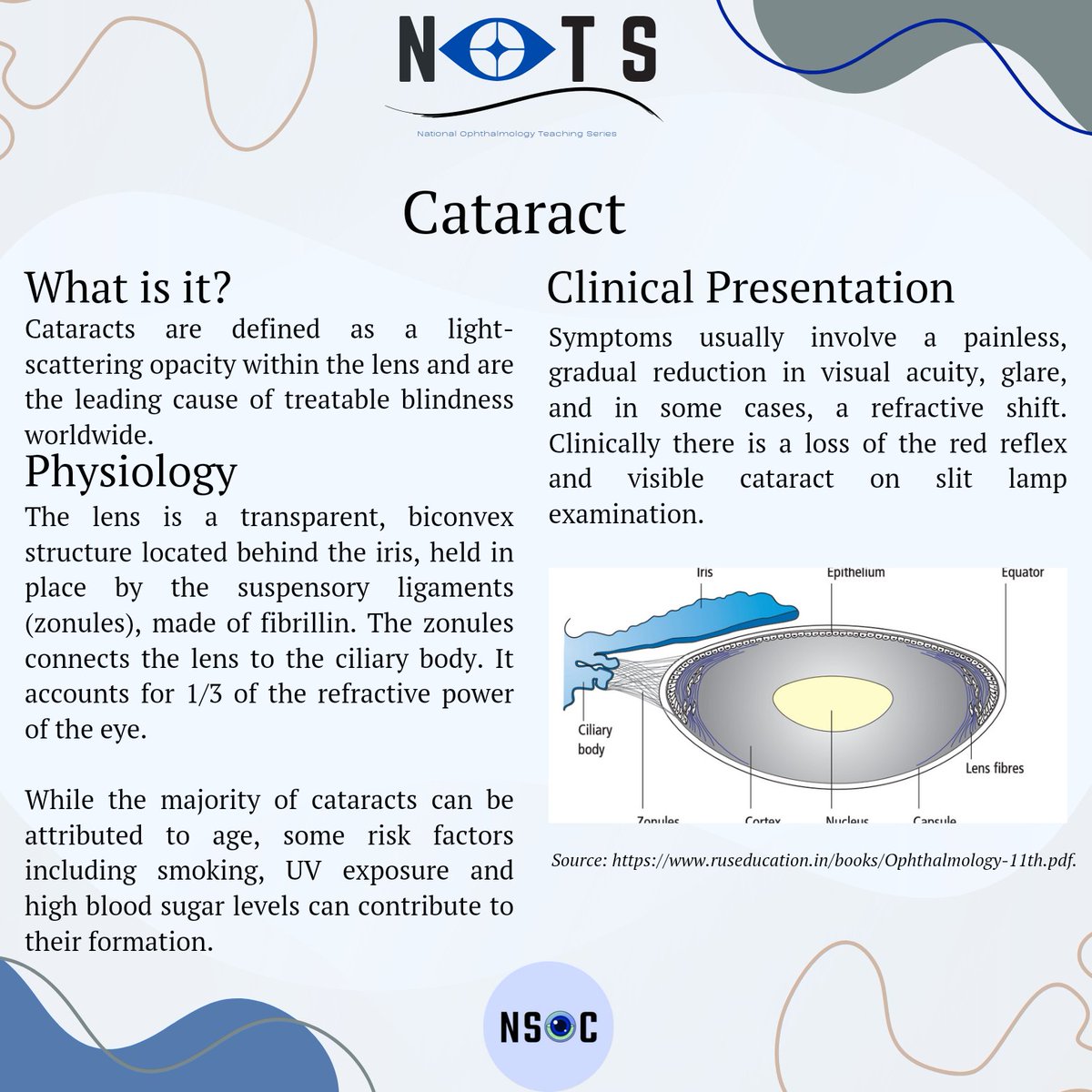 NatOphthalTeach's tweet photo. We are back with another of our fact sheets, this time on cataracts, which is still unfortunately one of the leading causes of blindness in the developing world. 

Keep a look out for our fact sheets which will be posted every 2 weeks ☺️

Author: Amelia Rees https://t.co/rrUd31KEzw