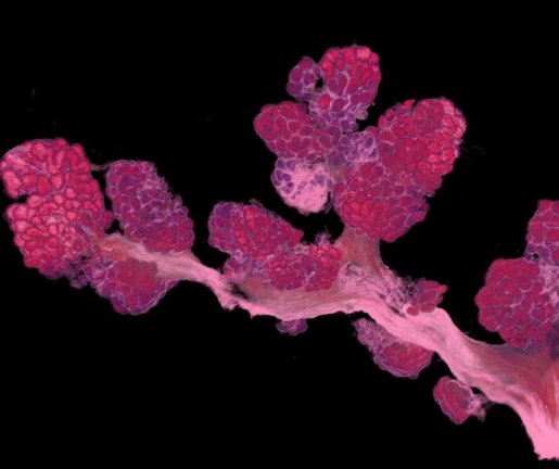Colinda Scheele (@colindascheele) on Twitter photo 👇🔬🧫Exciting story about human breast composition and 3D architecture in <a href="/CellReports/">Cell Reports</a>: cell.com/cell-reports/f…👇Led by <a href="/oonakaroliina/">Oona Paavolainen</a> and Markus Peurla (<a href="/EPeuhu/">Emilia Peuhu</a> lab <a href="/BioscienceTurku/">TurkuBioscience</a> ) with help of <a href="/kamyab_saberi/">Kamyab Saberi</a> and <a href="/larissamourao_/">Larissa Mourão</a> <a href="/vib_ccb/">CCB_VIB_KUL</a> <a href="/Onco_KULeuven/">Department of Oncology - KU Leuven</a> 👇🔬🧫Exciting story about human breast composition and 3D architecture in <a href="/CellReports/">Cell Reports</a>: cell.com/cell-reports/f…👇Led by <a href="/oonakaroliina/">Oona Paavolainen</a> and Markus Peurla (<a href="/EPeuhu/">Emilia Peuhu</a> lab <a href="/BioscienceTurku/">TurkuBioscience</a> ) with help of <a href="/kamyab_saberi/">Kamyab Saberi</a> and <a href="/larissamourao_/">Larissa Mourão</a> <a href="/vib_ccb/">CCB_VIB_KUL</a> <a href="/Onco_KULeuven/">Department of Oncology - KU Leuven</a>