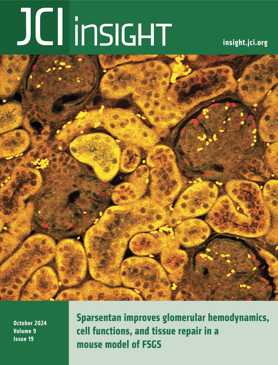 JCI insight (@jci_insight) on Twitter photo Sparsentan for focal segmental glomerulosclerosis. insight.jci.org/articles/view/β¦
Cover article from <a href="/gyarmatigina/">Georgina Gyarmati</a> et al reveals renoprotective mechanisms of dual ET-1 and AngII targeting in murine models.
<a href="/JPetiPeterdi/">Janos Peti-Peterdi</a> <a href="/USC/">USC</a> Sparsentan for focal segmental glomerulosclerosis. insight.jci.org/articles/view/β¦
Cover article from <a href="/gyarmatigina/">Georgina Gyarmati</a> et al reveals renoprotective mechanisms of dual ET-1 and AngII targeting in murine models.
<a href="/JPetiPeterdi/">Janos Peti-Peterdi</a> <a href="/USC/">USC</a>