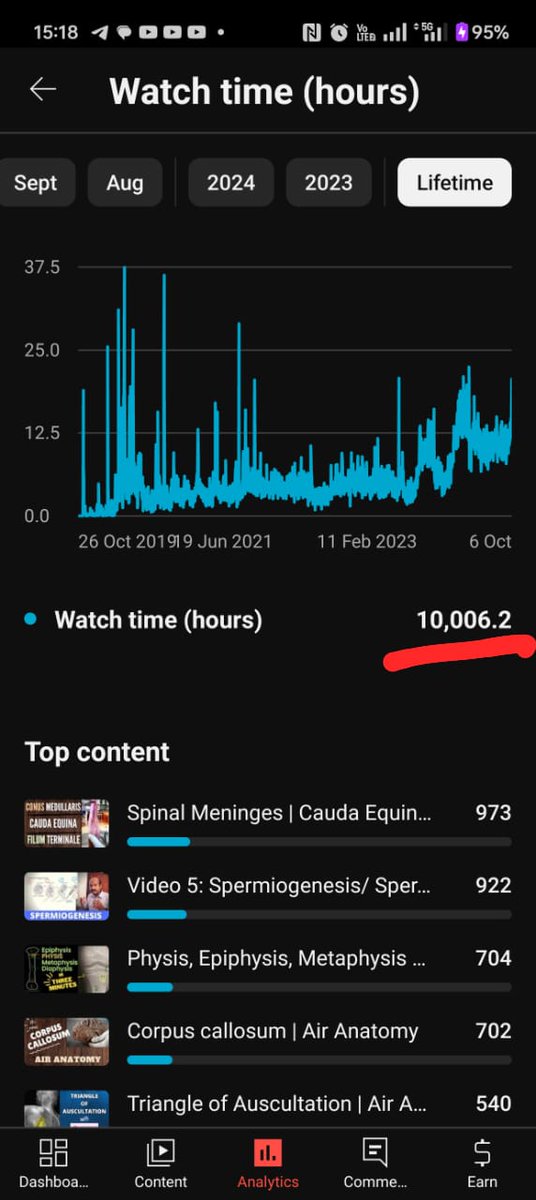 So today, people have spent 10,000 hours watching my "Air Anatomy" YouTube channel! 🎉
@AirAnatomy_Doris

#YouTube #Anatomy #MedEd