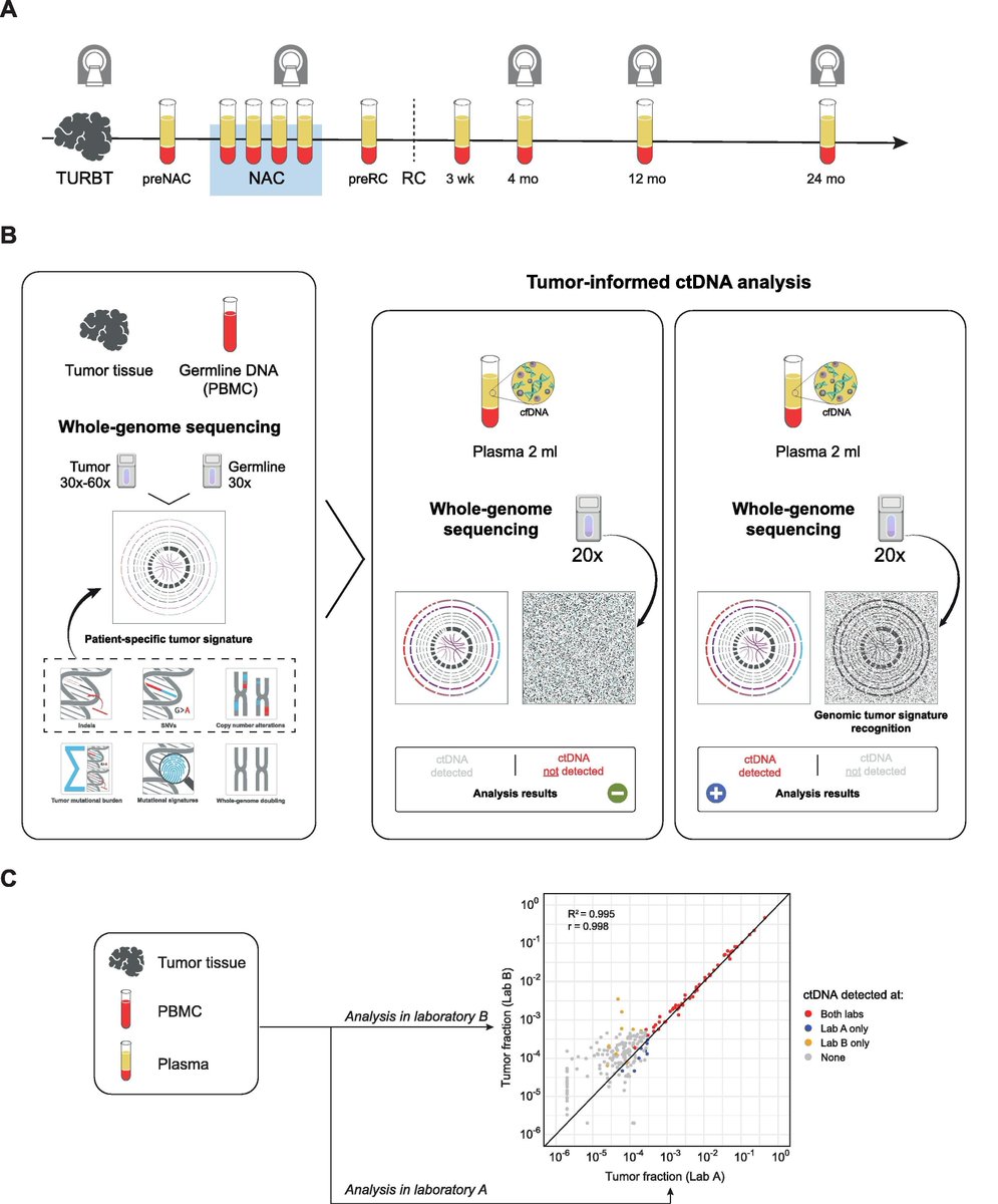 European Urology (@euplatinum) on Twitter photo Platinum Priority: Whole-genome Mutational Analysis for Tumor-informed Detection of Circulating Tumor DNA in Patients with Urothelial Carcinoma by <a href="/IverNordentoft/">Iver Nordentoft</a>, <a href="/SiaLindskrog/">Sia Viborg Lindskrog</a> et al
Full article: buff.ly/4evHWr8
Come back later to read the Editorial!
#UroSoMe Platinum Priority: Whole-genome Mutational Analysis for Tumor-informed Detection of Circulating Tumor DNA in Patients with Urothelial Carcinoma by <a href="/IverNordentoft/">Iver Nordentoft</a>, <a href="/SiaLindskrog/">Sia Viborg Lindskrog</a> et al
Full article: buff.ly/4evHWr8
Come back later to read the Editorial!
#UroSoMe