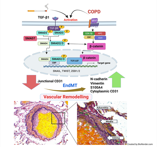 Portland Press (@pppublishing) on Twitter photo In this <a href="/Sohal_LabRTRG/">Respiratory Translational Research Group</a> research article, Bhattarai et al. investigate the roles of drivers of endothelial to mesenchymal transition, uncovering an active endothelial SMAD pathway, independent of TGF-β1 in smokers, SAD, and COPD patients. #ClinSci #Smoking
doi.org/10.1042/CS2024… In this <a href="/Sohal_LabRTRG/">Respiratory Translational Research Group</a> research article, Bhattarai et al. investigate the roles of drivers of endothelial to mesenchymal transition, uncovering an active endothelial SMAD pathway, independent of TGF-β1 in smokers, SAD, and COPD patients. #ClinSci #Smoking
doi.org/10.1042/CS2024…