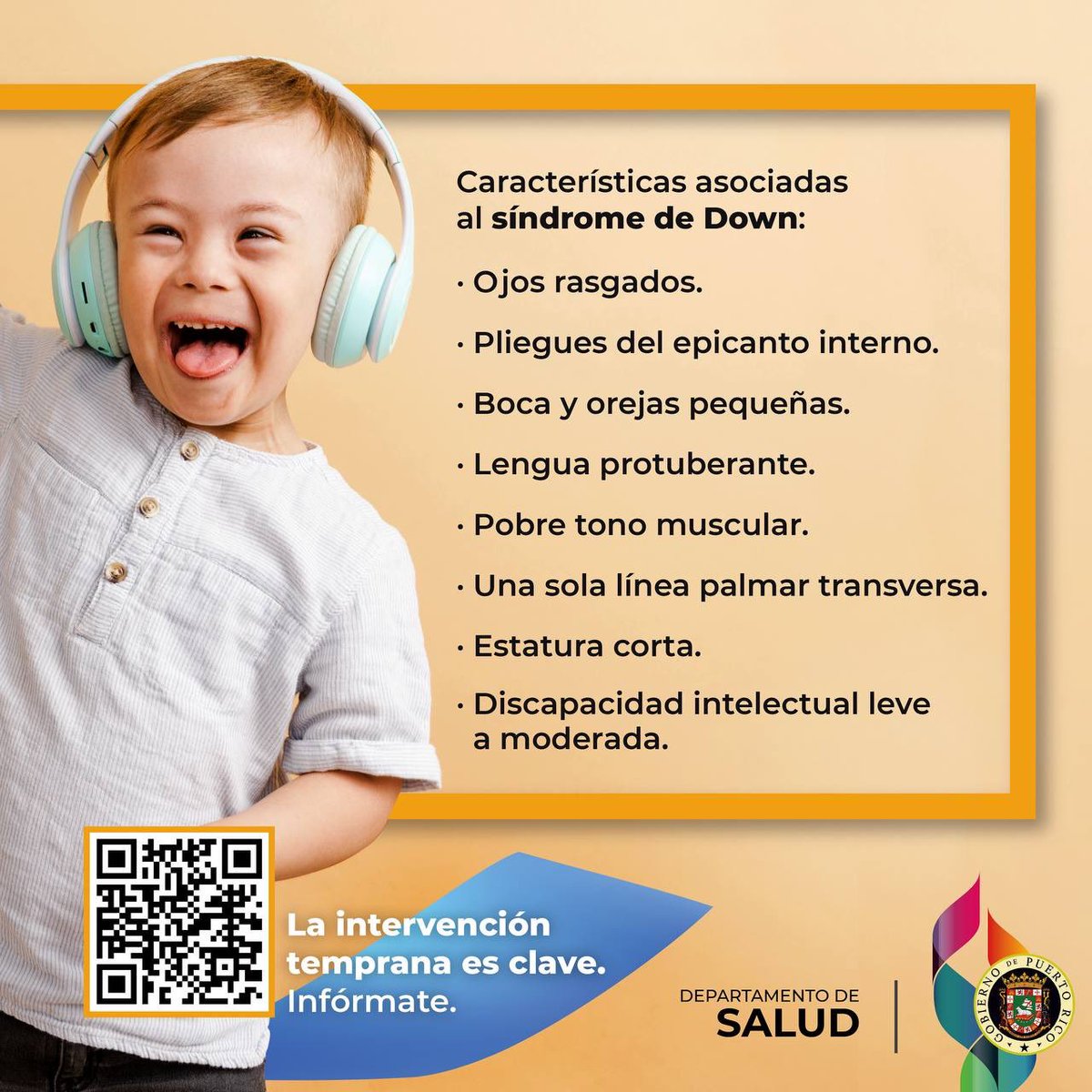 desaludpr's tweet photo. El síndrome de Down, atribuido a la presencia de un cromosoma extra, es uno de los diez defectos congénitos más comunes en Puerto Rico. Aunque las personas con este síndrome pueden parecerse y comportarse de manera similar, cada una tiene capacidades diferentes. https://t.co/CNbcL14fiM